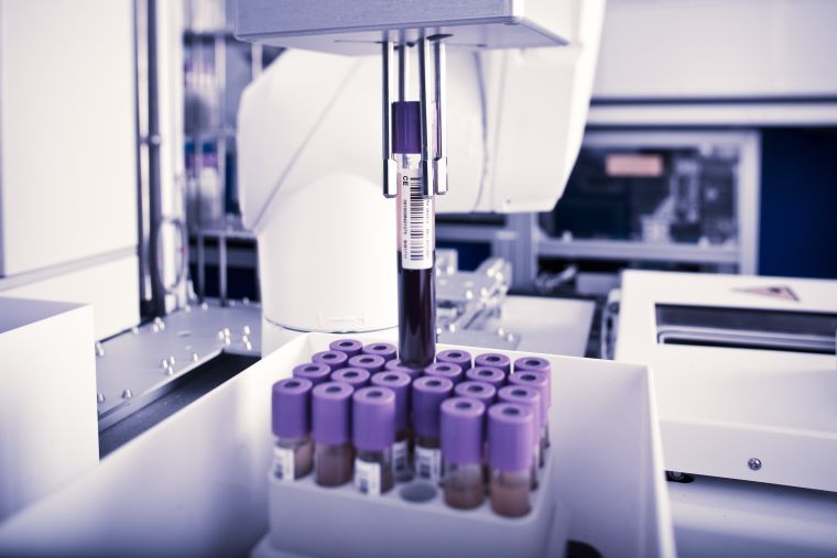 Blood sample processing at UK Biobank